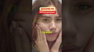 Sintomas ng Anemia Deficiency [upl. by Ibbie]