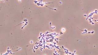 Moving pig sperm observed by biological [upl. by Nefets]