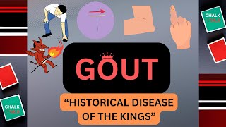 GOUT UNDERSTANDING THE DISORDER [upl. by Iad]