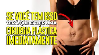 SE VOCÊ TEM ISSO TERÁ QUE FAZER UMA CIRURGIA IMEDIATAMENTE [upl. by Prentiss166]