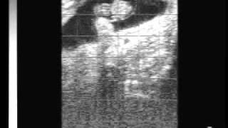 Bovine pregnancy 40 days with EasiScan ultrasoundwmv [upl. by Miof Mela]