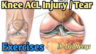 ACL ligament injury Exercises  ACL Strengthening Exercises  Grade 1 tear treatment  in hindi [upl. by Dorella]