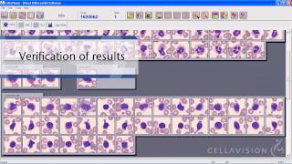 CellaVision DM Analyzers [upl. by Yeldahc754]