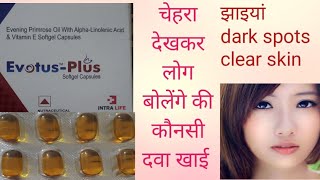 Medicines to boost Healthy Skin Nails Hair Joints amp Bones  HINDI  Hello Doctor Evotus Plus [upl. by Kerat]