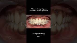 Braces Treatment magic braces braceslife orthodontist smile dentist music [upl. by Odnalor243]