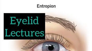 Eyelid lectures part 7 Eye opthalmology lectures  eyelectures eyelid ectropion jatoieye eye [upl. by Yllus381]