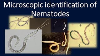 Microscopic identification of NematodesNematodesParasitologyMLSAscaris [upl. by Ahseinek]