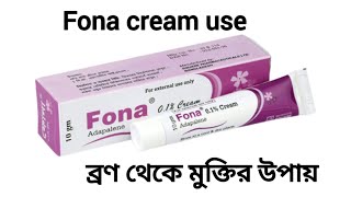 fona cream এর কাজ কি।fona cream use ব্রণ থেকে মুক্তির উপায়। [upl. by Carri]