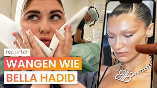 Buccal Fat Removal Schmale Wangen um jeden Preis  reporter [upl. by Murry]