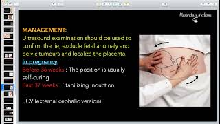 Malpresentation 2  OB course  Masterclass Medicine [upl. by Burke230]