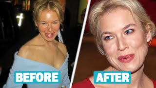 Renée Zellweger Plastic Surgery and Weight Loss Journey [upl. by Cami]