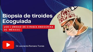 🔬Biopsia con aguja fina de tiroides ¿cuándo está indicada [upl. by Notfol]