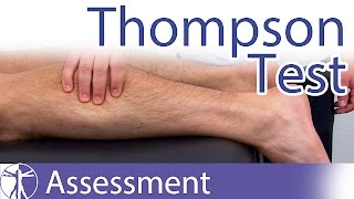 Thompson Test  Achilles Tendon RuptureTear [upl. by Magdalena405]