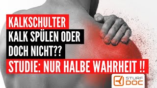 Kalkschulter  Placebo besser als Entfernung durch Spülung Diese Studie irrt schulterschmerzen [upl. by Ynafetse]