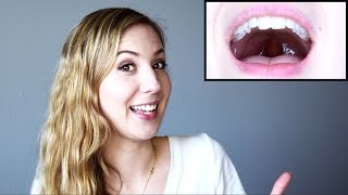 How to Raise Your Soft Palate and Open Your Voice [upl. by Holihs904]