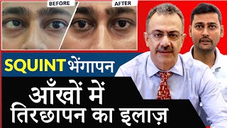 भेंगापन तीरछापन का इलाज  Near LIVE Squint Surgery Demonstration [upl. by Brahear]