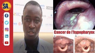 Santé🔴Cancer de lhypopharynx avec Dr Ndour Médecin Orl à Lhôpital Universitaire de Fann de Dakar [upl. by Hakon]