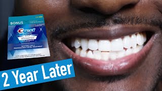 Crest 3D Whitestrips 2 Years Later How to Whiten Teeth EASY [upl. by Atsirak581]