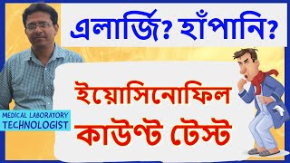 Absolute Eosinophil Count Test  অ্যাবসোলিউট ইয়োসিনোফিল কাউণ্ট টেস্ট [upl. by Naujaj153]