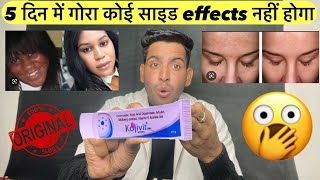 5 दिन में गोरा  Kojivit gel  Kojivit gel kaise use kare  kojivit gel review  kojivit plus gel [upl. by Karlens]