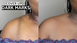 HOW TO COVER UP DARK MARKS FAST [upl. by Amos]