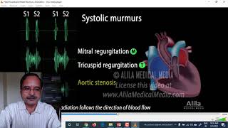 Lecture 13 Hearts Sounds Phonocardiography [upl. by Fenn970]