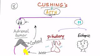 Cushing Syndrome Diagnostic Workup [upl. by Ttenrag]