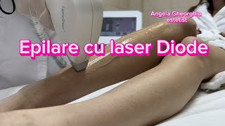 Epilare definitivă cu laser LUMENIS [upl. by Hteb878]