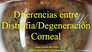 Diferencias entre la Distrofia y la Degeneración Corneal [upl. by Haisoj]