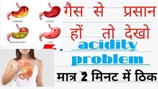 dompan acidity गैस से prasan hai  Dompan tab use how To acidity problem with solusane kya hai [upl. by Ennaeirrac]