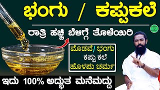 Pigmentation Treatment on Face in Kannada  Bhangu Nivarane Mane Maddu  Bhangu on Face kannada [upl. by Smeaj]