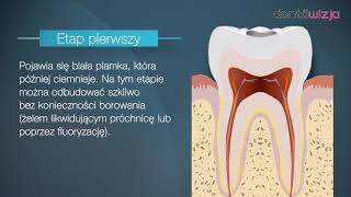 Jak powstaje próchnica [upl. by Ibloc104]
