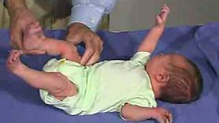 physical exam Newborn Normal TonePopliteal Angle [upl. by Alard]