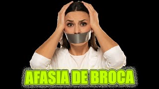 La increíble realidad de la afasia de Broca😱  3 min ⏰ Neuropsicología [upl. by Treva805]