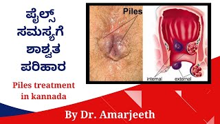 Piles Treatment in Kannada  ಪೈಲ್ಸ್ ಬರದಂತೆ ತಡೆಯುವುದು ಹೇಗೆ  Piles Symptoms in Kannada [upl. by Amle]