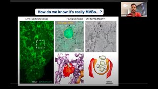 Liveimaging approaches to explore exosome biology in vitro and in vivo by Frederik Verweij [upl. by Korb140]