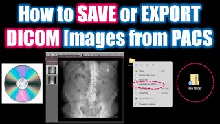 How to save DICOM images from PACS howto radiology dicom [upl. by Aurita22]