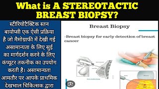 Stereotactic Breast Biopsy in HindiWhat is Stereotactic breast biopsy Biopsy radiologymamography [upl. by Forsta193]