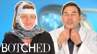 Dr Nassif Fixes Lisa’s Facelift Gone Wrong FULL TRANSFORMATION  Botched  E [upl. by Shlomo]