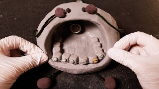 ASMR 꼬마돌 4탄 🌚💎 반짝반짝 치아 교정 상황극 한국어자막치아 스케일링 Little Stone Jewelry Scalingorthodontic RPSUB [upl. by Ibloc]