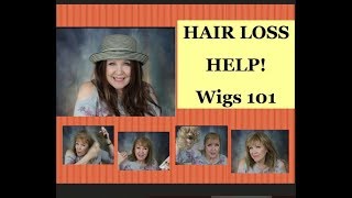 HAIR Loss Help Wigs amp Hairpieces 101  regrowth productscareoptions [upl. by Matti]