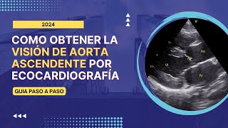 🎯Como obtener la 🎨VISION DE AORTA ASCENDENTE por ECOCARDIOGRAFÍA Guía paso a paso [upl. by Yrelav]