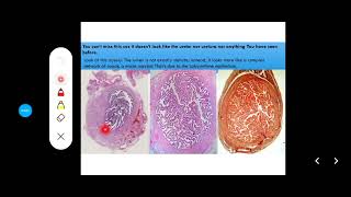 Histology Slides Series Episode 15  Histology of the Female Reproductive Organs and Mammary Gland [upl. by Neufer]