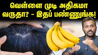 Myths amp Truths about White Hair  வெள்ளை முடி  உண்மைகளும் பொய்களும்  Uyirmei Episode  31 [upl. by Arenat]