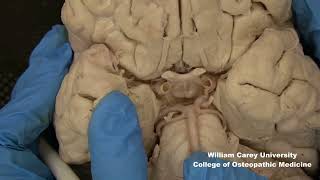 Ventral brainstemhypothalamus neuroanatomy hypothalamus brainstem anatomymedicalstudentbrain [upl. by Anemolihp]