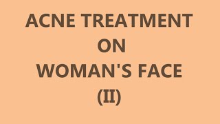 Acne Treatment on Womans Face II  Left side [upl. by Yerok]