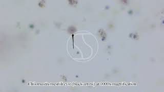 Chilomastix mesnili Cyst under the microscope [upl. by Amitak]