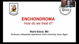 Lecture7  Enchondroma “How do we treat it” 📝🩺 [upl. by Yriek361]