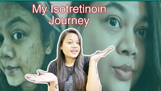 ISOTRETINOIN TABLETS Update after 1 Year  Does isotretinoin remove acne permanently [upl. by Nodearb]