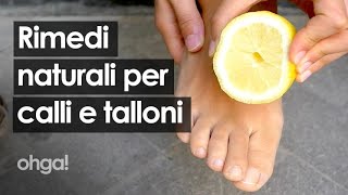 Rimedi naturali per calli e talloni screpolati dal bicarbonato allaceto di vino [upl. by Pattin748]